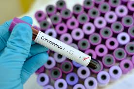 [Audio] Hasta el momento son 6 los casos confirmados de coronavirus en el país