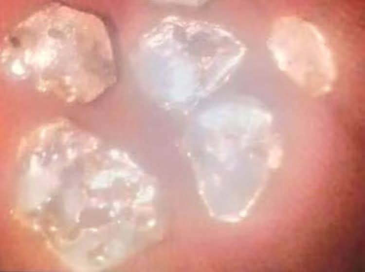 Buscaban agua y encontraron oro en Caapucú