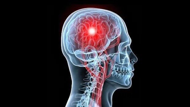 ACV: claves para entender una amenaza silenciosa y prevenible